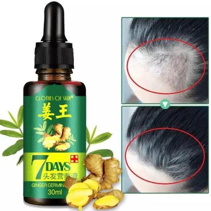Anti-Hair Loss Hair Serum
